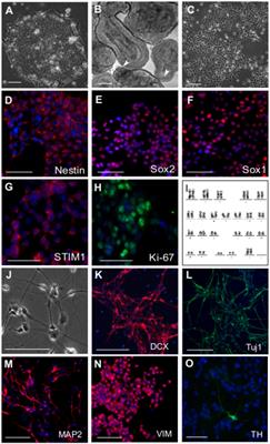 Stable STIM1 Knockdown in Self-Renewing Human Neural Precursors Promotes Premature Neural Differentiation